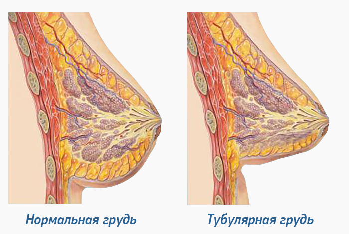 Очень большие соски у девушки