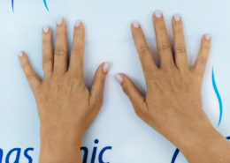 käte täitesüstid, käte niisutamine, kuivad käed, kortsus käed, täitesüst, ilusüstid, biorevitalisatsioon, Christinas Clinic, iluprotseduurid, iluprotseduur