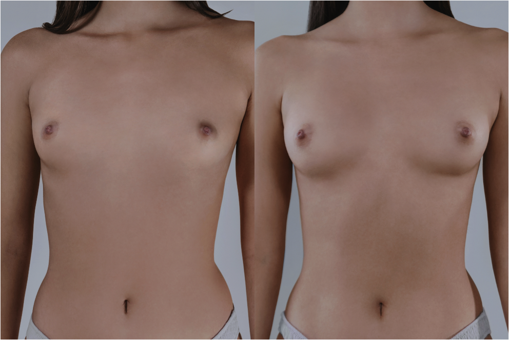 Andrea topless