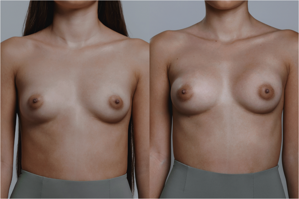 Isabel topless