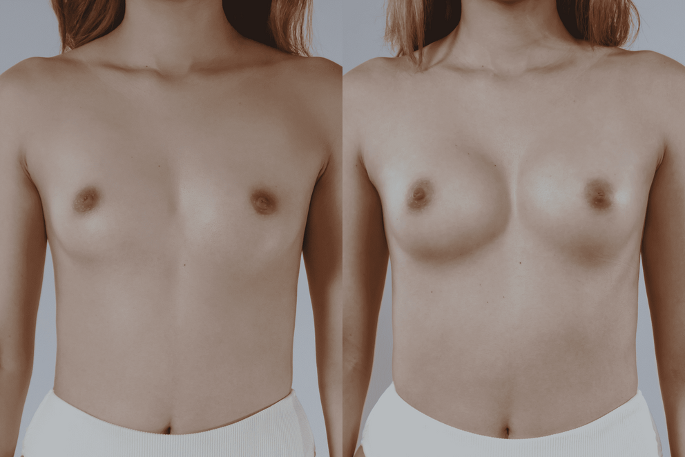 Vanessa topless