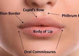 lip lift
